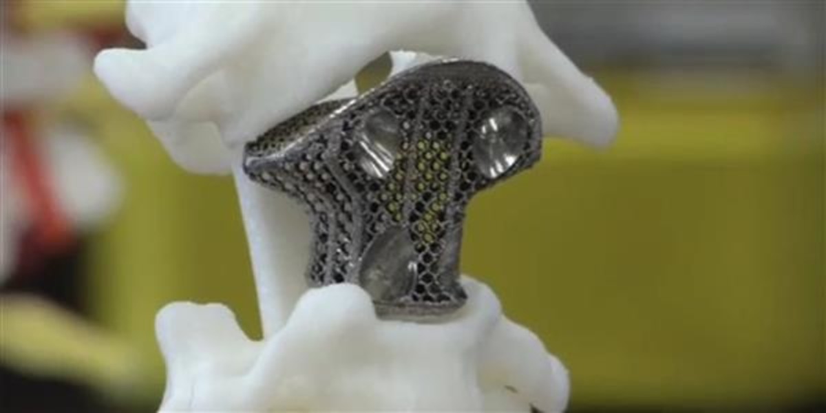 Will batch 3D printing become a replacement for the injection molding process?